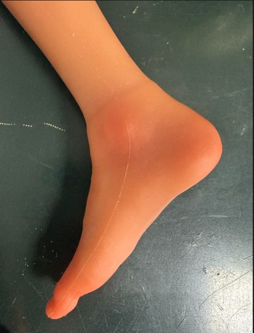 Hard feet